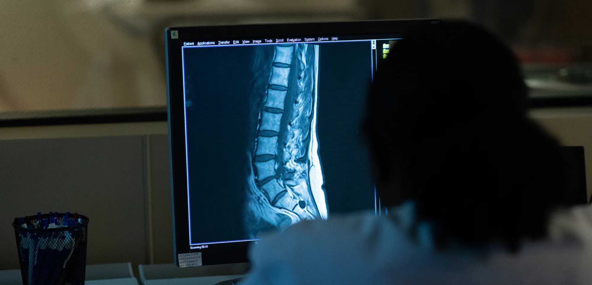 Radiography student looking at an x-ray of a spine.